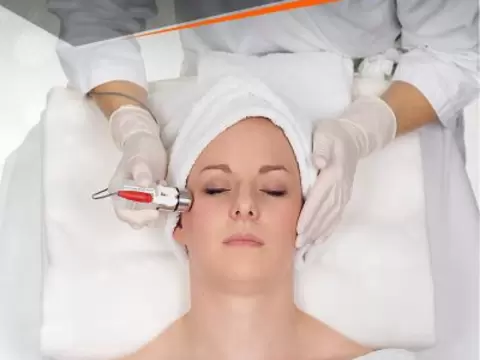 Durchführung einer Mesoporation bei Kosmetik Oppenheimer